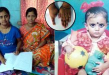 জন্মের পরেই চিকিৎসা বিভ্রাটে ডান হাতের চারটি আঙুল খুইয়েও দুর্গাপুরের ঈশিতা প্রতিবন্ধকতাকে জয় করে এখন স্নাতক স্তরের ছাত্রী