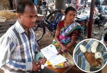 চিকিৎসায় গাফিলতি, স্যালাইন দেওয়া হাত বাদ যেতে বসেছে রোগীর
