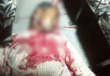 বাসে-বাসে ঘষা দুর্গাপুরের মুচিপাড়ায় থেঁতলে গেল যুবকের মাথা