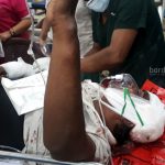 injured-tmc-worker-gouridevi-hosp1