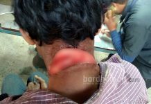 নাদনঘাটে জামাইবাবুর ঘাড়ে ছুরির কোপ শ্যালকের, পড়ল ২৫টি সেলাই